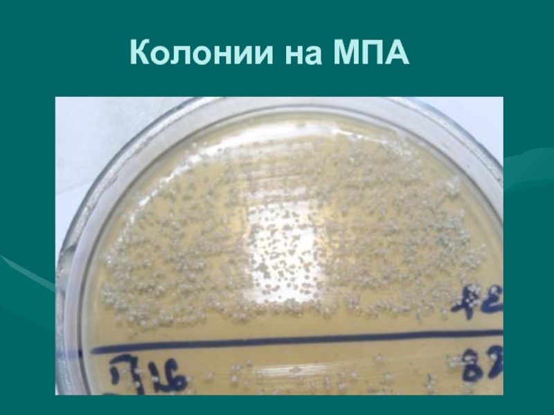 Посев мпа. Мясопептонный агар (МПА). Колонии на мясопептонном агаре. Колонии бактерий на МПА.