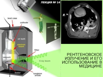 Рентгеновское излучение и его использование в медицине. (Лекция 14)