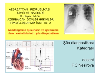 Anadangəlmə qüsurların və qazanılma ürək xəstəliklərinin şüa diaqnostikası