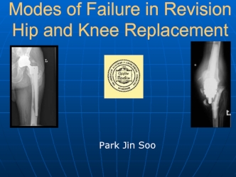 Modes of failure in revision hip and knee replacement