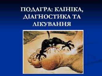 Подагра: клініка, діагностика та лікування