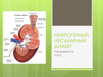 Нефрогенный несахарный диабет