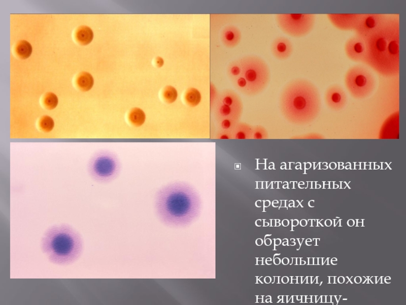 Chlamydia trachomatis mycoplasma genitalium