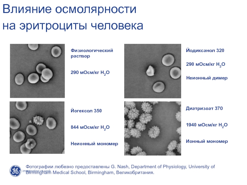 Ученые изучали действие на эритроциты раствора nacl. Влияние растворов на эритроциты. Эритроциты в физиологическом растворе. Влияние солей на эритроциты. Влияние воды на эритроциты.