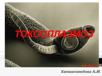 Токсоплазмоз