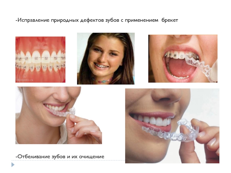 -Исправление природных дефектов зубов с применением брекет -Отбеливание зубов и их очищение