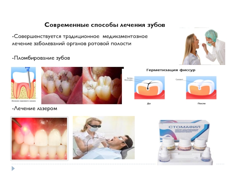 Современные способы лечения зубов -Совершенствуется традиционное медикаментозное  лечение заболеваний органов ротовой полости