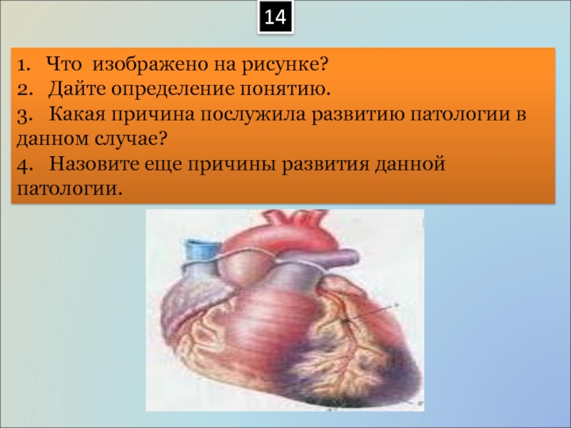 Патология 1. Презентации по основам патологии. Основы патологии презентация. .Назовите причины данной патологии. Какая патология изображена на картинке.