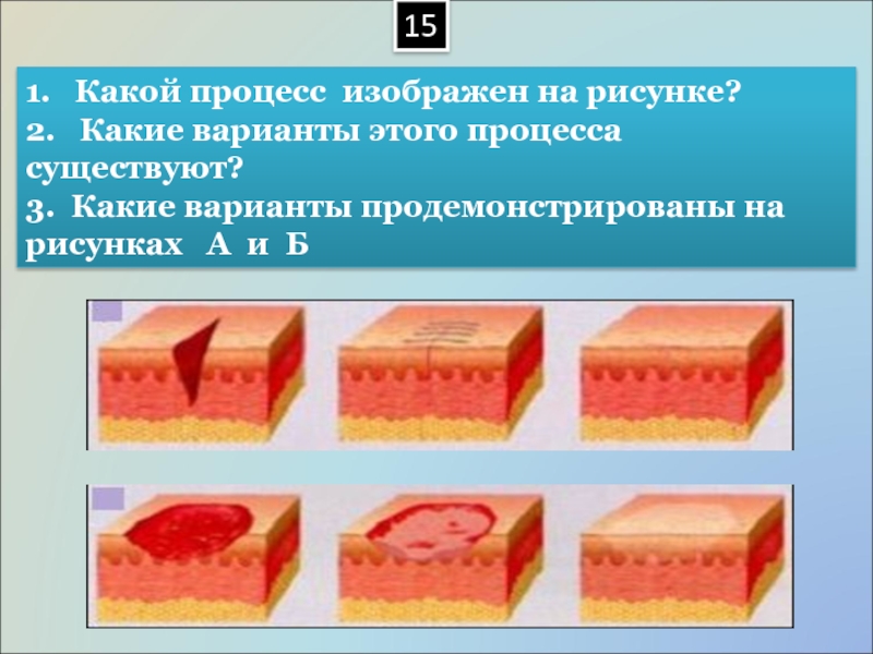 Какие процессы существуют. Основы патологии рисунок. Какая патология изображена на рисунке. Картинка по основам патологии. Какая патология изображена на картинке.