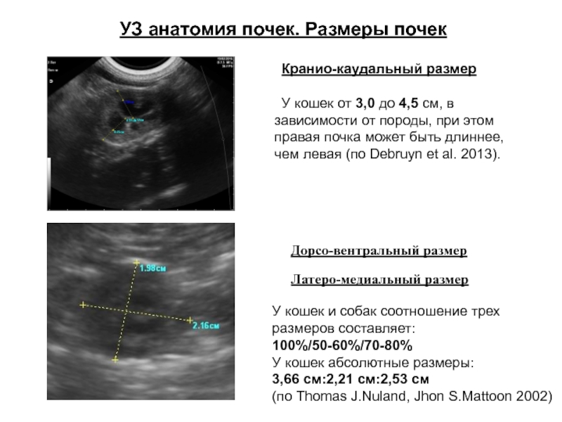 Ультразвуковое исследование в таблицах и схемах капустин