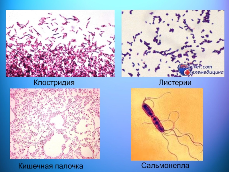 Исследование на токсины клостридий. Сальмонелла, кишечная палочка. Палочки клостридии. Патогенность клостридий. Кишечная палочка морфология.