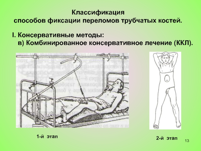 Способы фиксации переломов