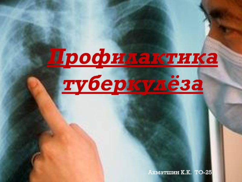Профилактика туберкулёза   Ахматшин К.К. ТО-25