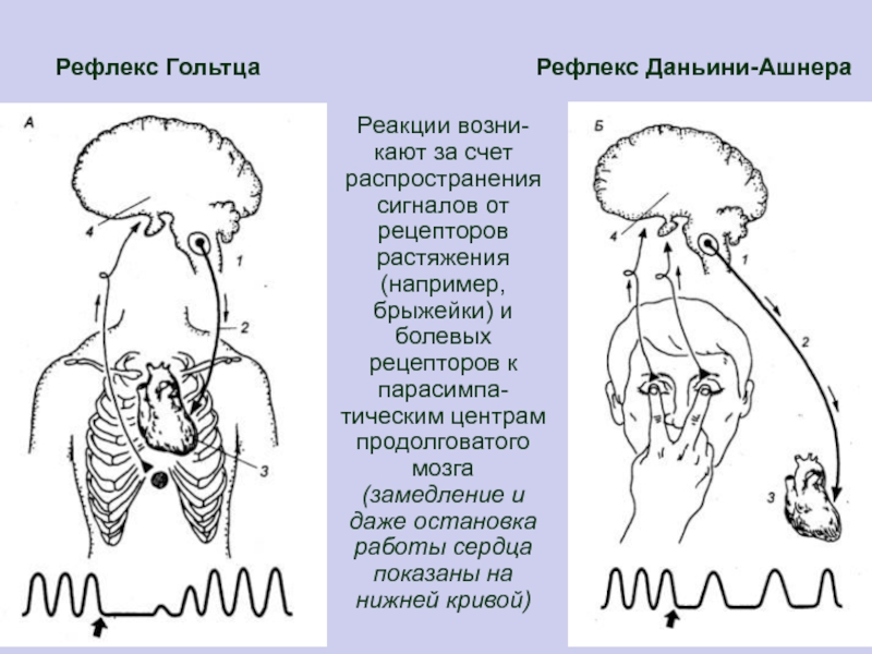 Глазосердечный рефлекс схема