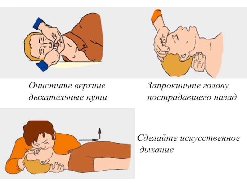 Как проводить искусственное дыхание