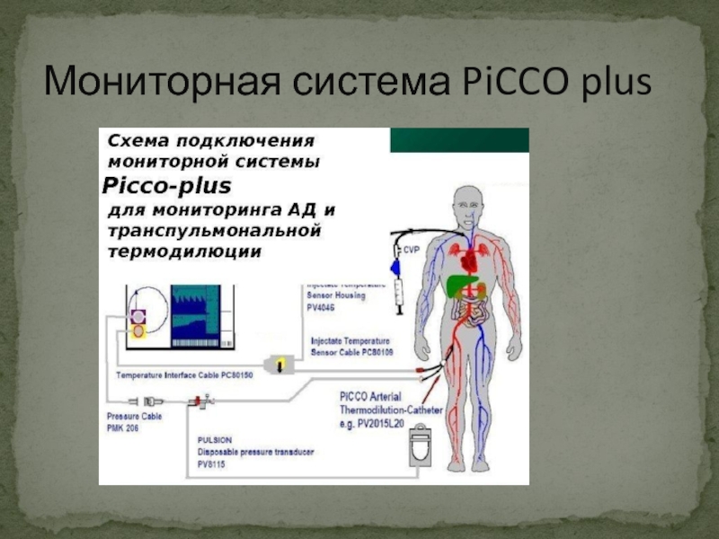 Мониторная система PiCCO plus