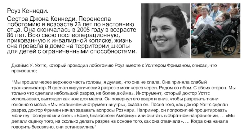 Кеннеди лоботомия. Сестра Джона Кеннеди. Сестра Джона Кеннеди Лоботомия. Розмари Кеннеди. Сестра Джона Кеннеди - Розмари Кеннеди.