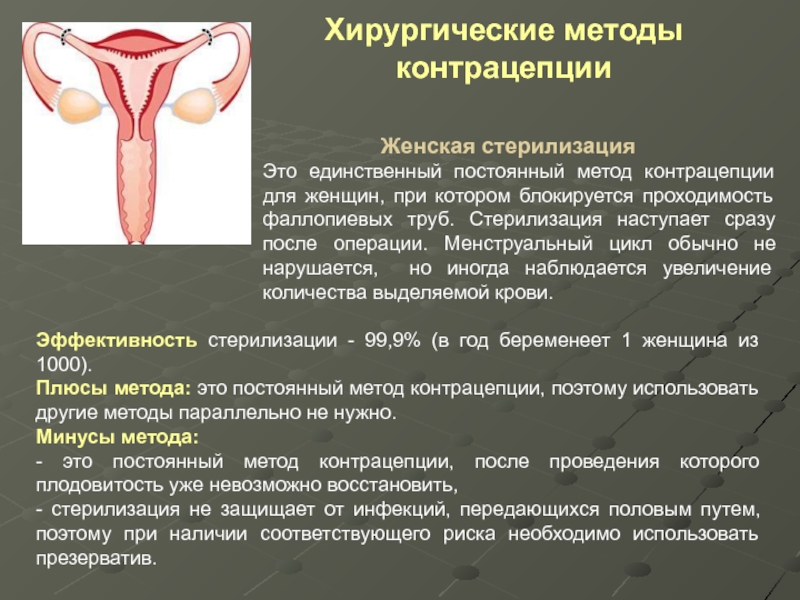 Реферат: Механические и хирургические методы контрацепции