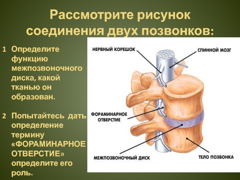 Соединения позвоночника суставы. Соединение позвонков вид сбоку. Соединения между позвонками суставы. Соединения позвонков анатомия. Соединение позвонков между собой.