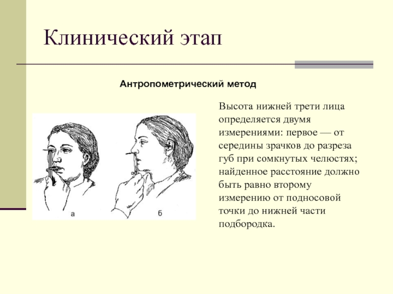 Нижняя треть. Высота нижней трети лица. Определение высоты Нижнего отдела лица. Антропометрический метод определения высоты Нижнего отдела лица. Определение нижней трети лица.