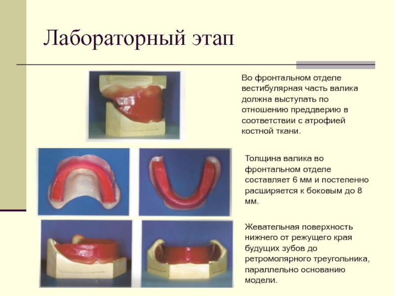 Полный съемный пластиночный протез презентация