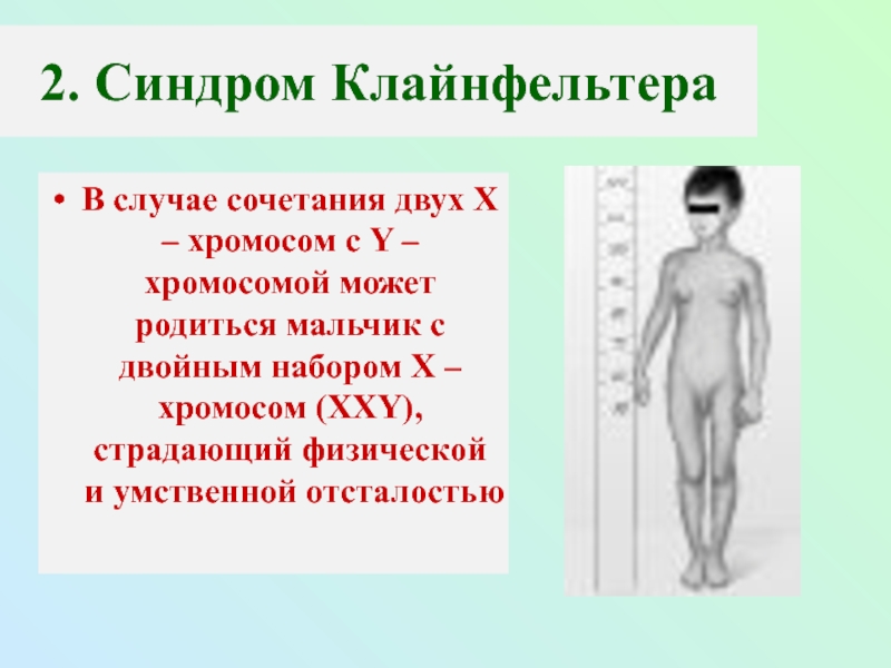 Xxy хромосома. Синдром Клайнфельтера гетероплоидия. Синдром Клайнфельтера 47 xxy. Синдром Клайнфельтера у мужчин. Синдром Клайнфельтера схема хромосом.