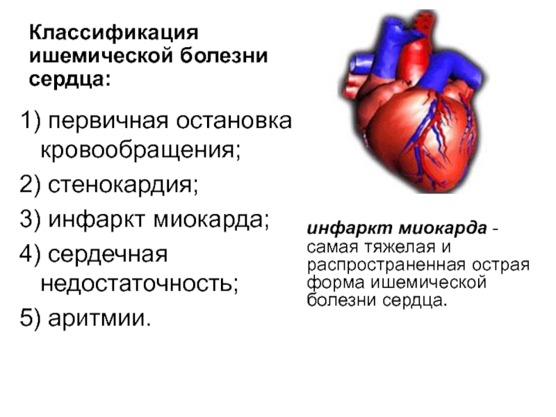 Стабильная ишемическая болезнь сердца презентация