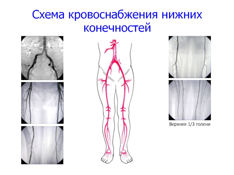 Кровообращение в ногах схема