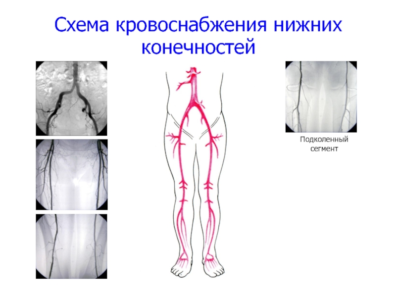 Схема узи вен нижних конечностей