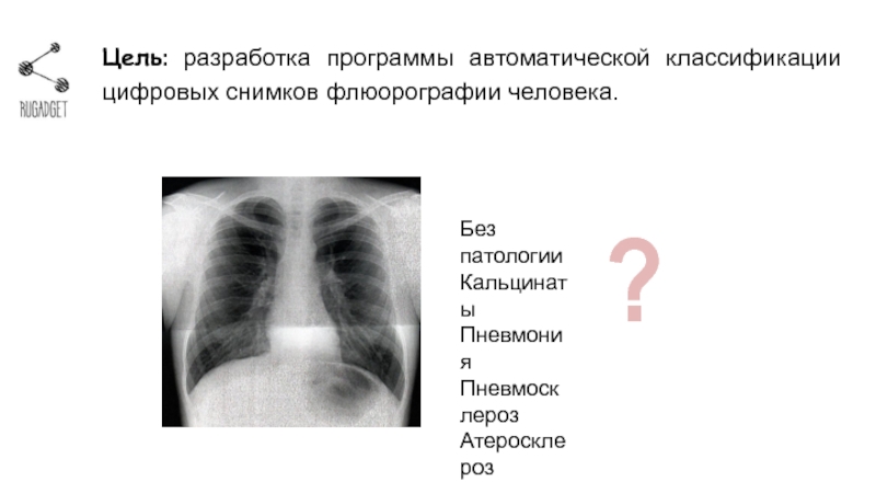 Без патологии. Флюорография расшифровка снимков. Описание флюорографии. Заключение флюорографии с патологиями. Цифровая флюорография результат.