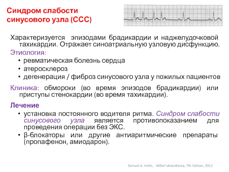 Наджелудочковая тахикардия карта вызова смп