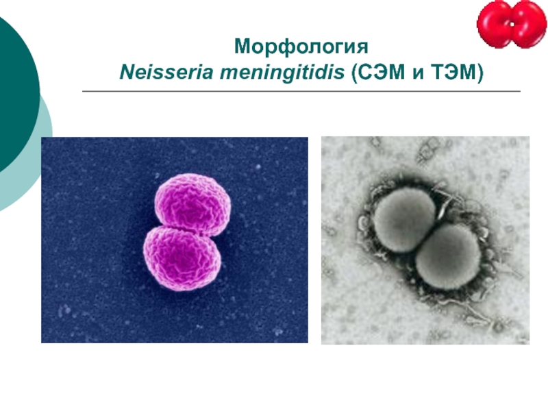 Менингококки микробиология. Морфология Neisseria meningitis. Neisseria meningitidis морфология. Менингококки морфология.