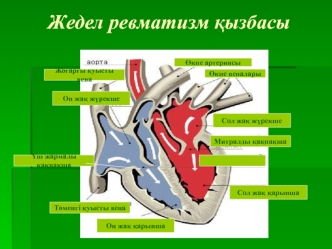 Жедел ревматизм ќызбасы