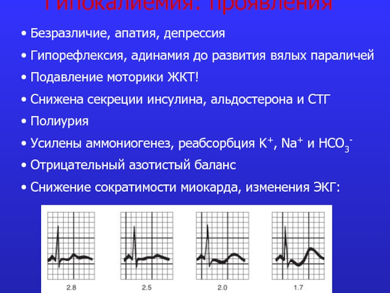 Гипокалиемия