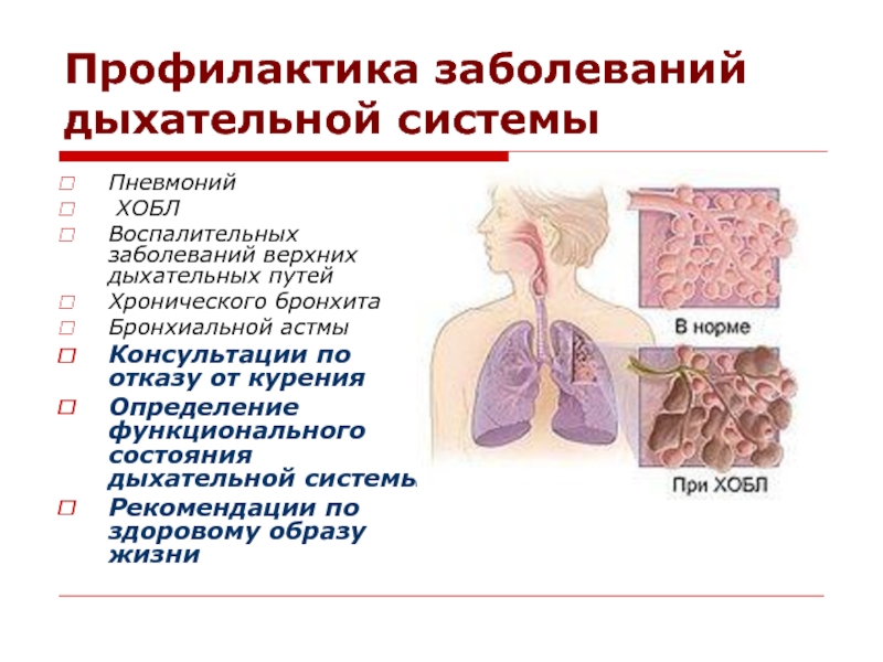 Презентация на тему заболевания дыхательной системы