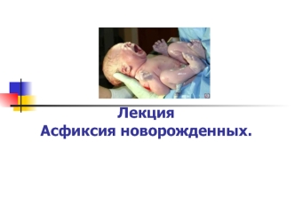 Асфиксия новорожденных