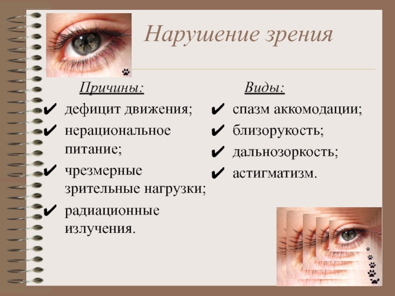 Причины заболевания зрения. Причины нарушения зрения. Типы нарушения зрения. Факторы нарушения зрения. Нарушения остроты зрения виды.