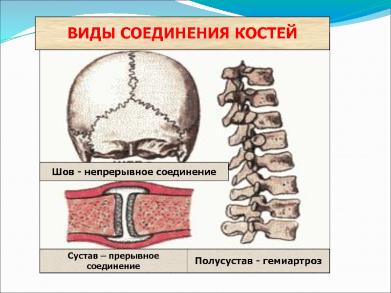 Какой тип соединения костей изображен на рисунке какие анатомические структуры этого типа соединения