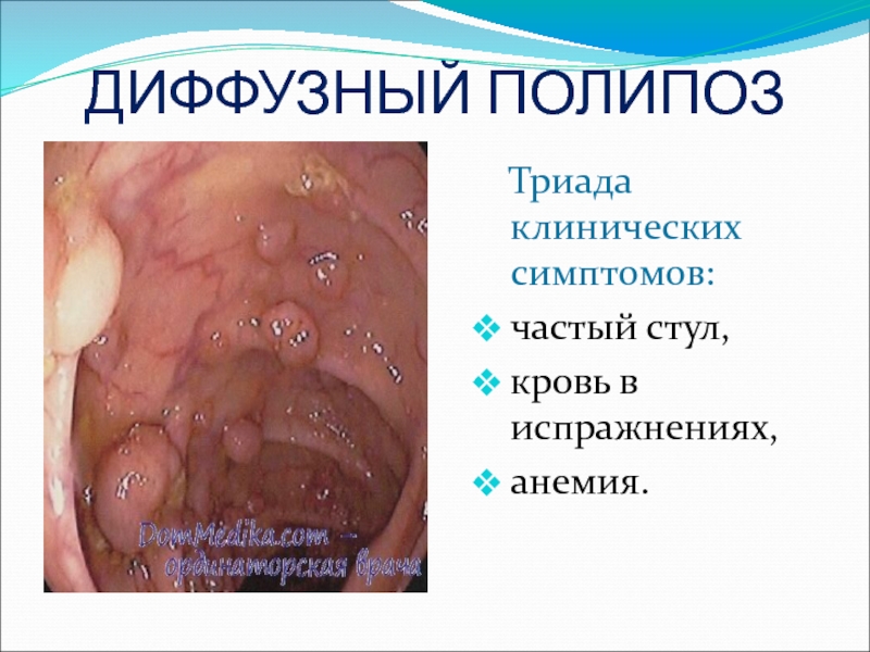 Частый стул малыми порциями