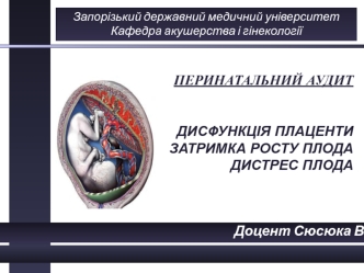 Перинатальний аудит. Дисфункція плаценти. Затримка росту плода. Дистрес плода