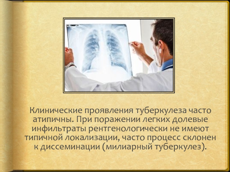 Появление туберкулеза. Клинические симптомы фтизиатрии. Клинические проявления туберкулеза. Клиническая картина туберкулеза.