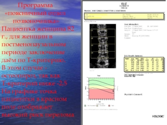 Программа         поясничный отдел                позвоночника Пациентка женщина 82 г., для женщин в постменопаузальном периоде заключение даём по T-критерию.                                                  В этом случае - остеопороз, так как            