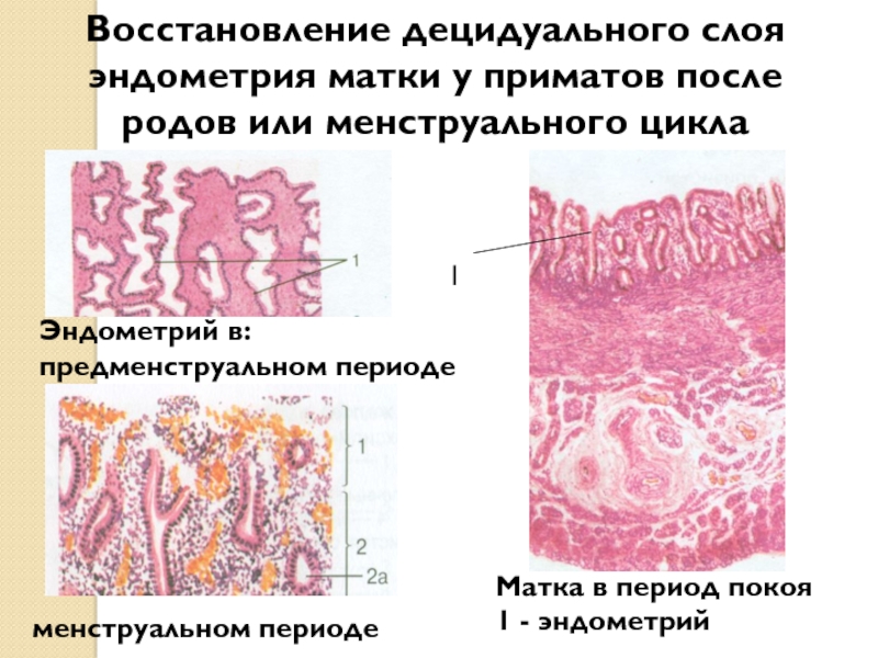 Децидуальная эндометрия. Матка предменструальный период препарат гистология. Базальный слой эндометрия. Регенерация слизистой матки.