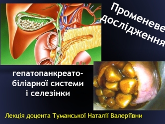 Променеве дослідження гепатопанкреатобіліарної системи і селезінки