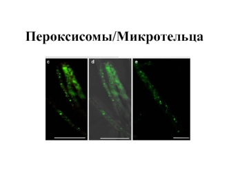 Пероксисомы/Микротельца