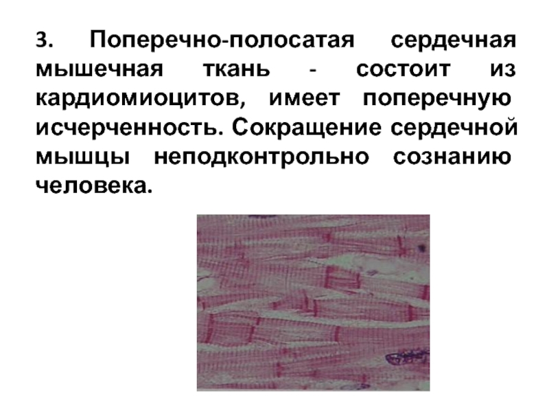 Особенности поперечно полосатой сердечной ткани. Поперечнополосатая сердечная мышечная ткань. Сердечная мышечная ткань исчерченность. Поперечно полосатая мышечная ткань ткань. Поперечная исчерченность в сердечной мышечной ткани.