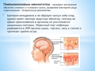 Пневмококковый менингит