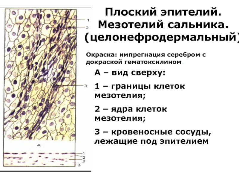 Граница клетки. Однослойный плоский эпителий мезотелий сальника. Мезотелий сальника кролика препарат. Мезотелий сальника препарат гистология. Клетки пласта мезотелия.