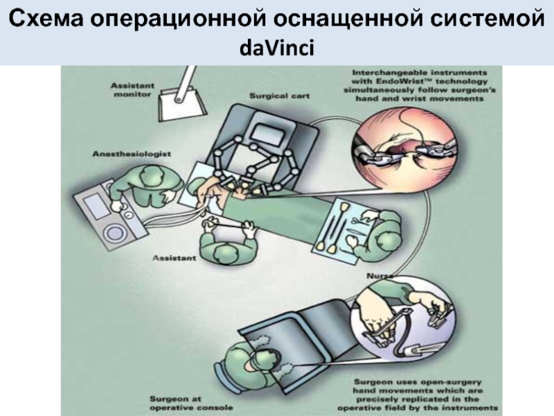 Операционная схема дает