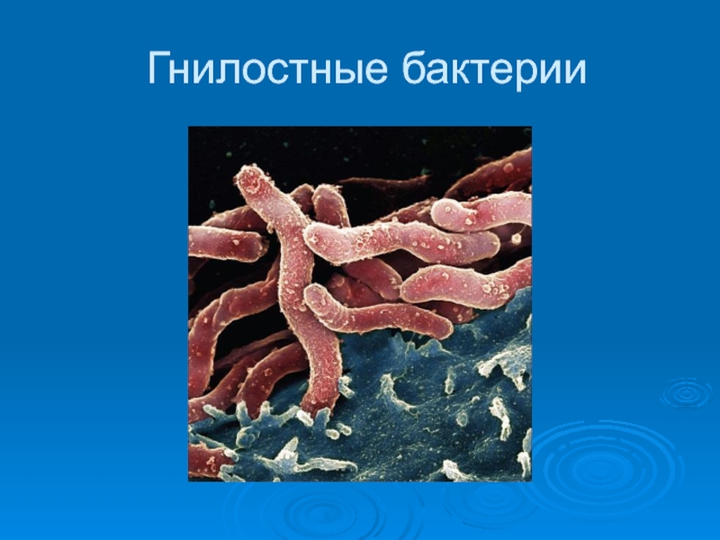 Признаки гнилостных бактерий. Гнилостные бактерии 5 класс биология. Бактерии гниения. Разлагающие бактерии.